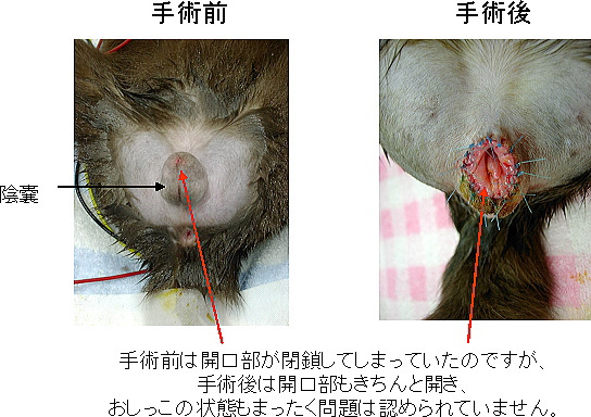 包茎 方 カントン 治し